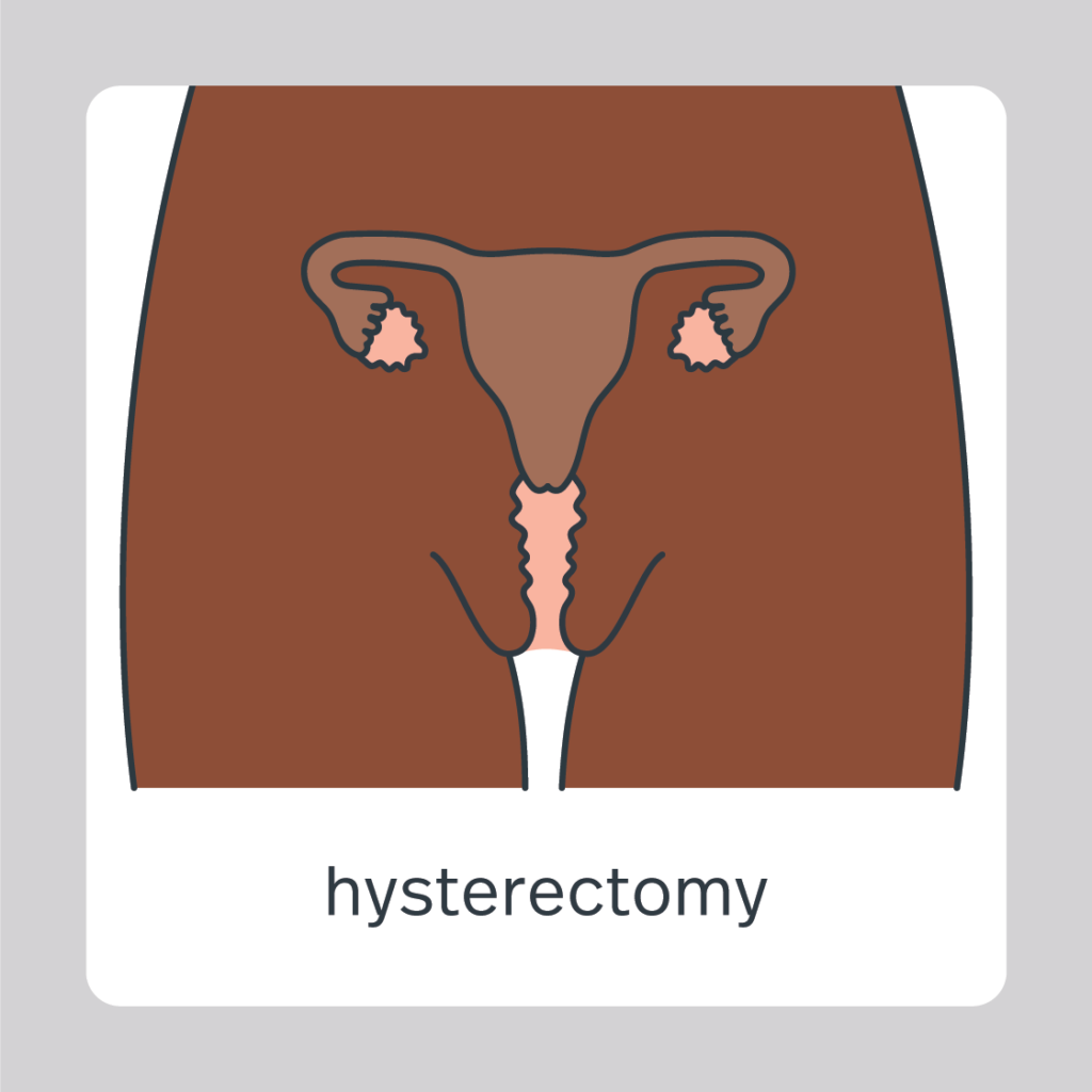 hysterectomy