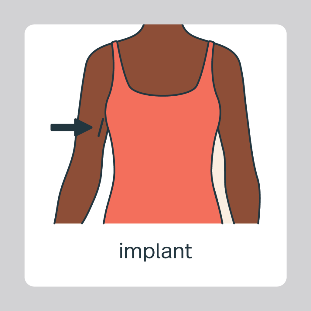 implant clothed