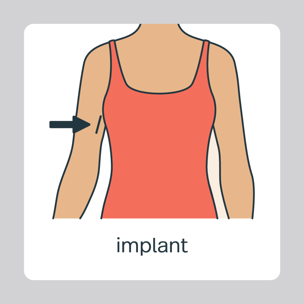 implant clothed