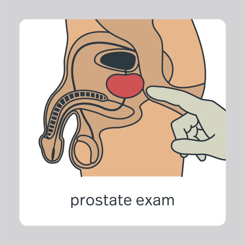 prostate exam