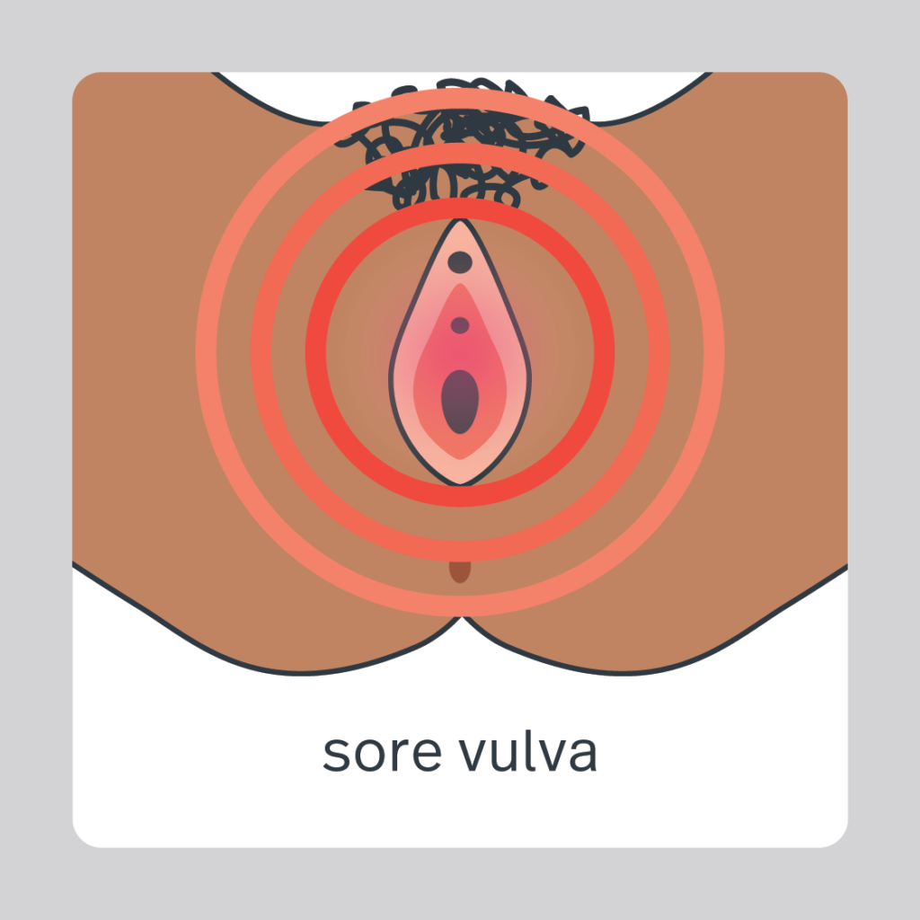 sore vulva